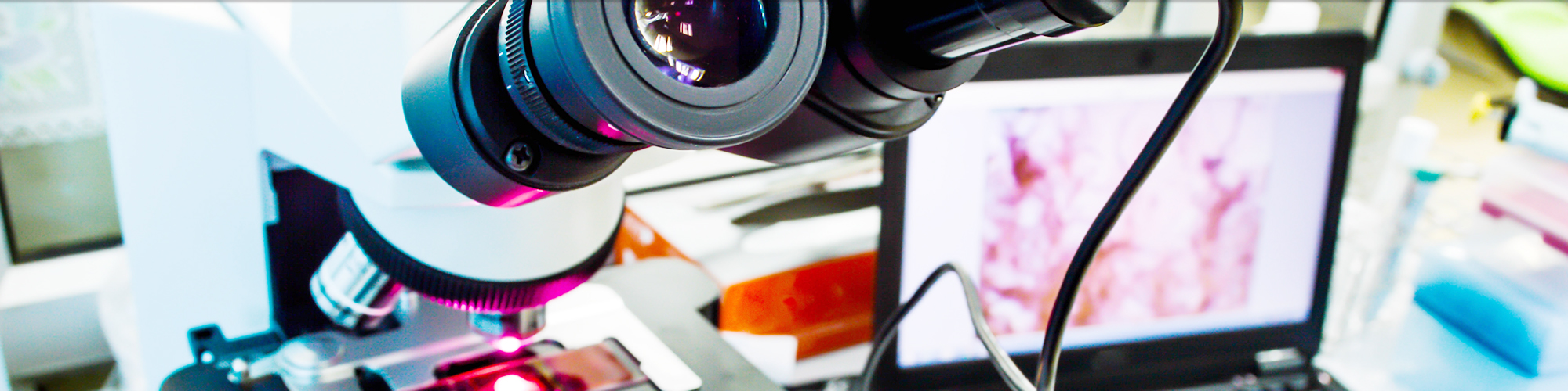 Microscope with a Laptop