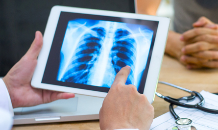 Doctor Showing a X-Ray